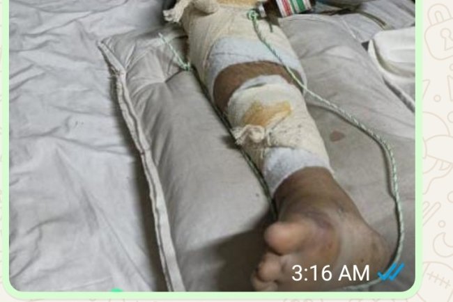 বাংলাদেশের প্রত্যেকটি অলিতে গলিতে ব্যাটারি চালিত অটোরিকশার কা