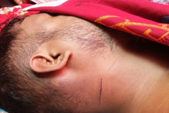 হিজলায় মিষ্টি কারখানায় সর্টসাকিটে শ্রমিক মৃত্যু