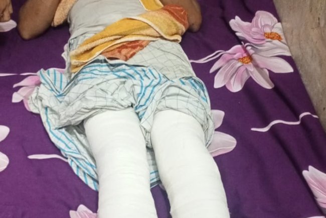 মাদক ব্যবসায় বাধা দেওয়ায় স্কুল শিক্ষককে পিটিয়ে দুই পা ভেঙে দেয়া